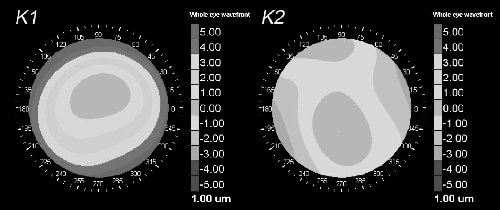 K1 and K2 from figure 1