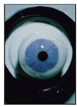 Prosthetic contact lens